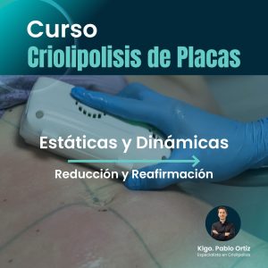 Criolipólisis de Placa